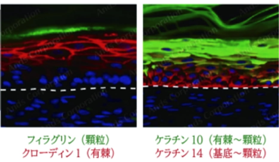 表皮構成タンパク質の局在